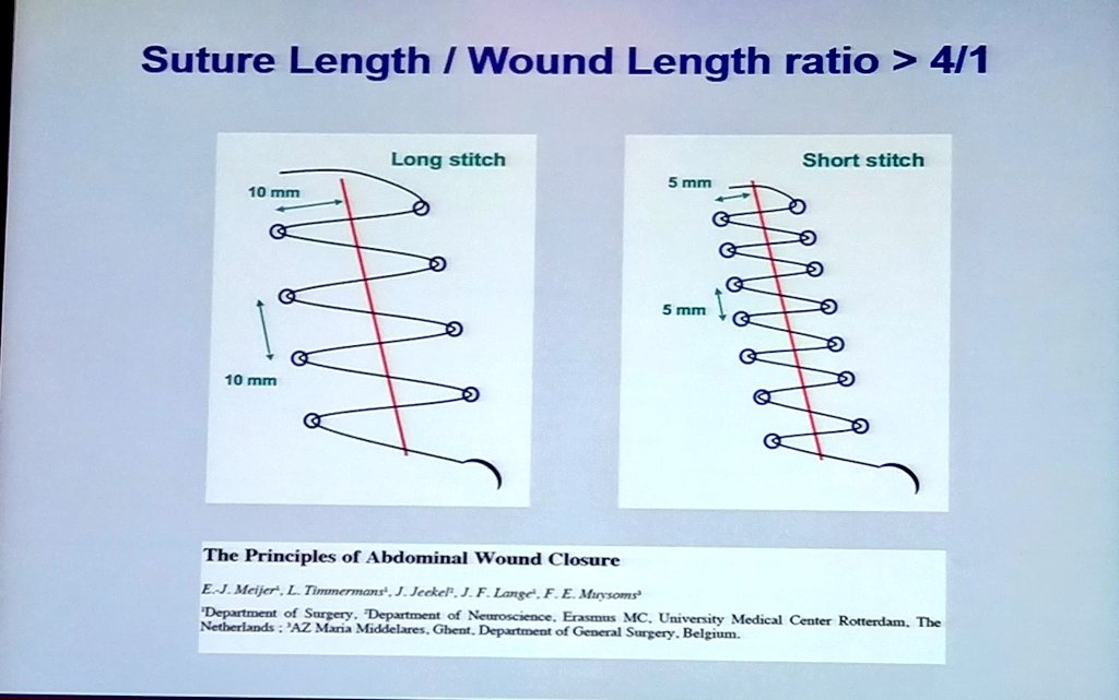 hgok's tweet photo. Filip Muysoms from Belgium 🇧🇪 Open Access: where & how to close? recommends small bites technique
#UFK2017 #FıtıkCerrahisi #HerniaSurgery https://t.co/RJF6cLI1Ox