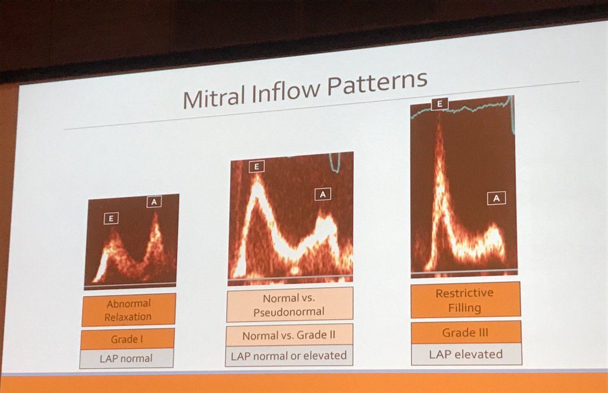 rooshaparikh's tweet photo. Diastolic function finally made easy by Dr.Saric #ECHONY2017 #ACCFIT #cardioed @danilov_tatyana @patelapurva @becky_naoulou @HeartToProve https://t.co/0cBA9EKPD9
