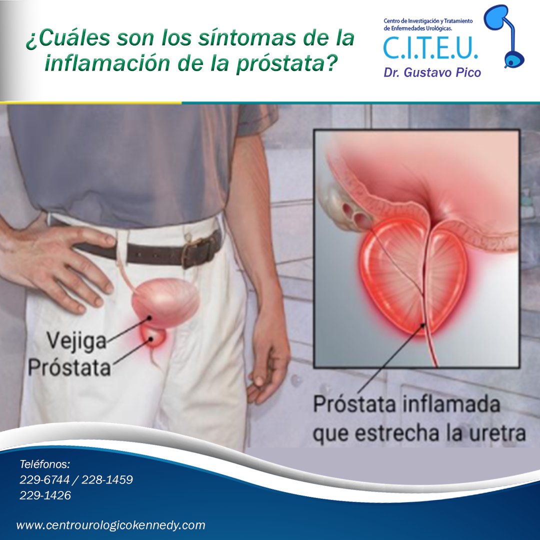¿Qué es la inflamación de la próstata?