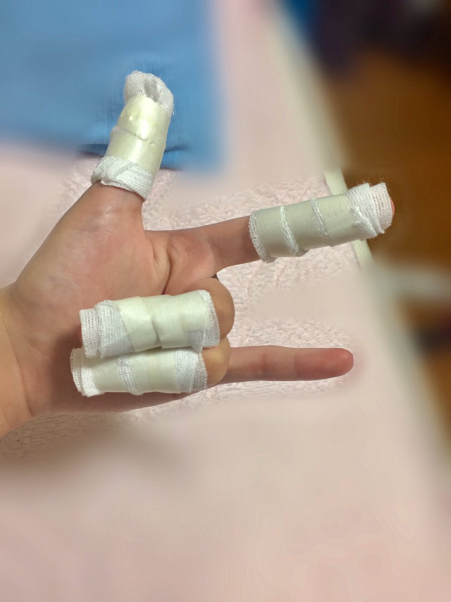Bot28981545's tweet photo. 320度の石焼に触るとこーなる卍卍 https://t.co/RJJpuSCecO