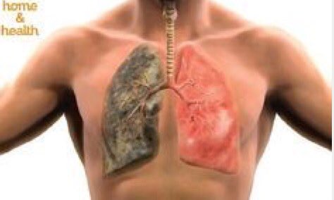 Don't let big tobacco destroy your health. Make the right choice.  #quitsmoking #tobacco is highly addictive.