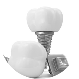ElQuirinal's tweet photo. #SaludBucodental La perdida de #piezas #dentales conllevan más #problemas de los aparentes Visítanos ➦ @ElQuirinal ttps://goo.gl/3yPPDs https://t.co/tHRQ41nqwy