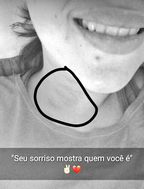 thinkingofkat's tweet image. Postei isso no meu stts do whats e ninguém percebeu os arranhões...