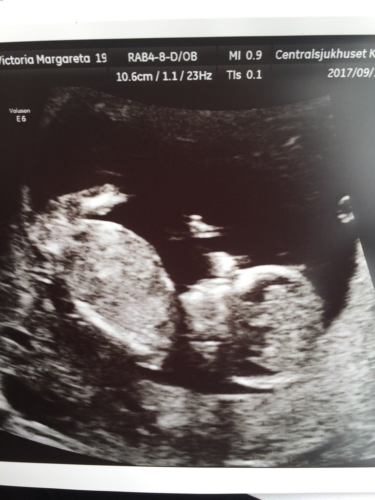 En ny vänsterfotad och högerskytt är på g. 👶