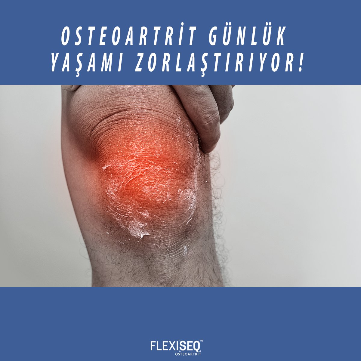 FLEXISEQtr's tweet photo. Hareketle artan ağrı, kişilerin günlük yaşam aktivitelerini yerine getirmelerine neden olur. https://t.co/7yQ5L2D89h