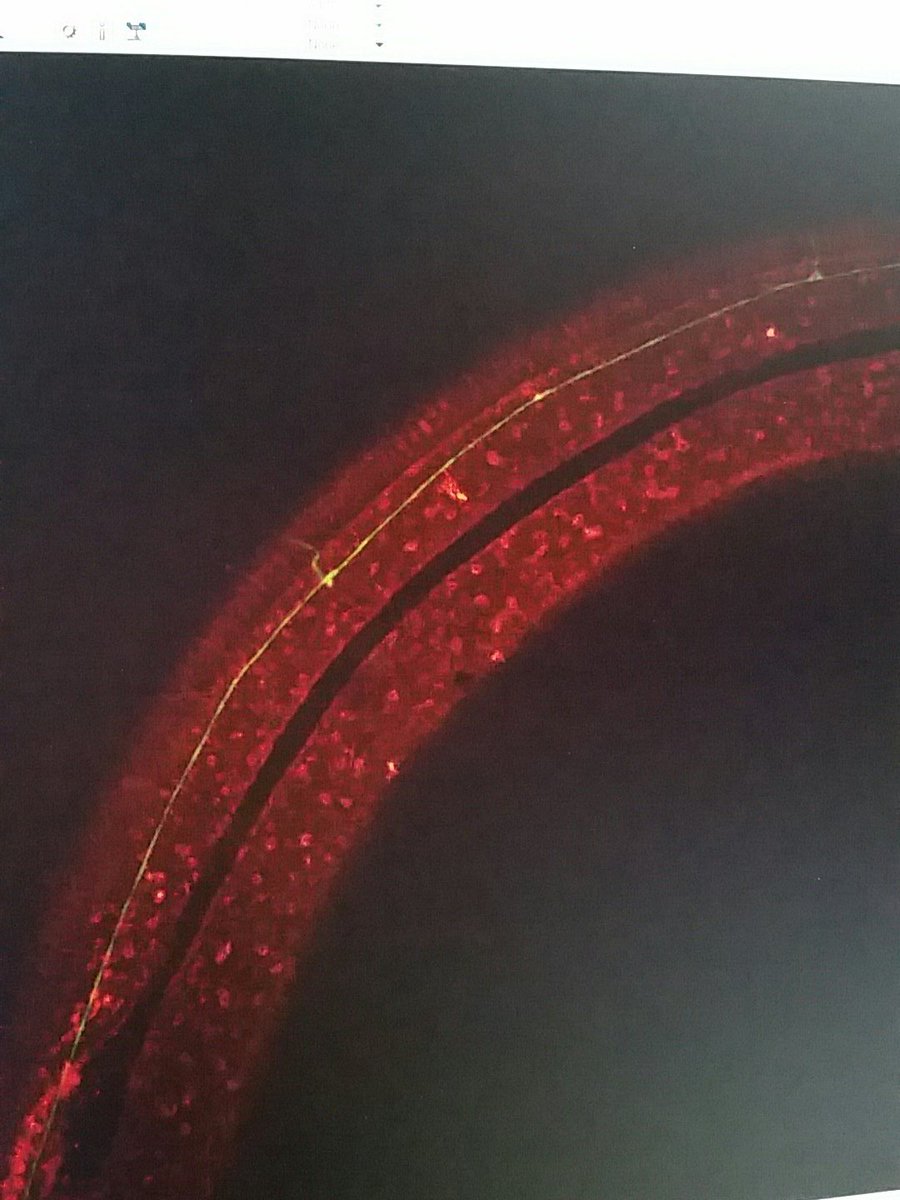 stcoakley's tweet photo. Smashing some spinning disk confocal 🔬 playing with my new meta account 🖱📃 and listening to the new killers album 🎧 #multitaskmonday https://t.co/sxcBO6VNc5