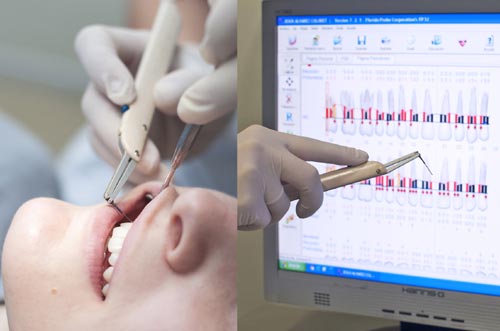 CLELBRUS's tweet image. Disponemos de la última tecnología de diagnóstico y seguimiento del tratamiento periodontal: la Sonda Florida goo.gl/2SPdJX