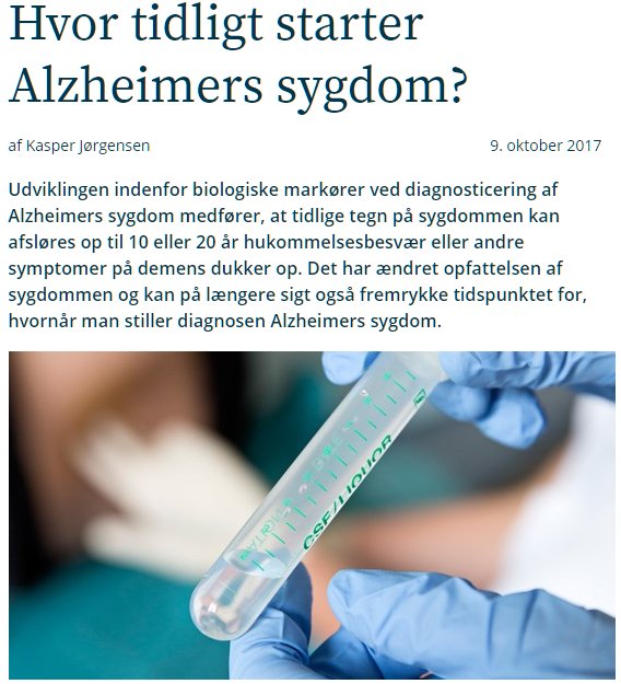 alzheimer demens