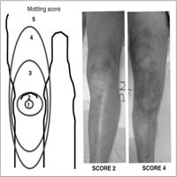 Most Popular: Monitoring of the physical exam in sepsis dlvr.it/PtMk0g