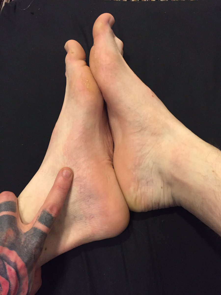 feet size 11