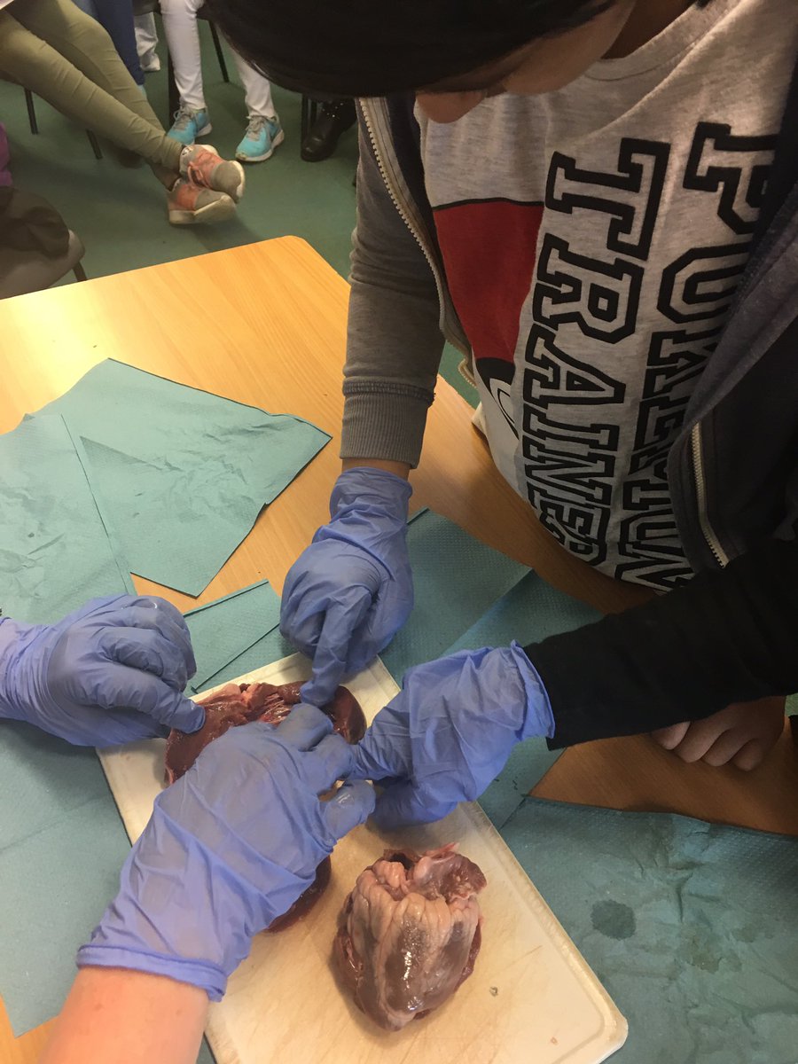 ElmWoodHead's tweet photo. We are operating on @ollyofficial heart today to stop it from skipping a beat!! #Olly #SaveOlly @BCPS_MrsG https://t.co/BhNC6l44k9