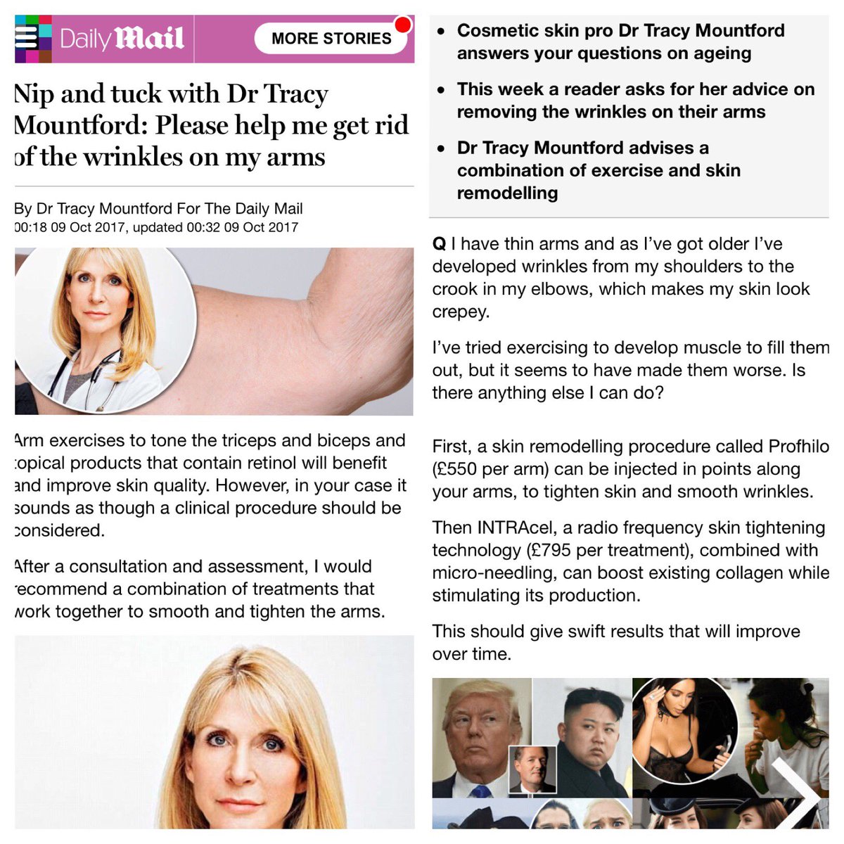 Thank you Dr Tracy 😊 #Profhilo #bioremodelling #collagen #elastin <a href="/cos_skinclinic/">Cosmetic Skin Clinic</a>