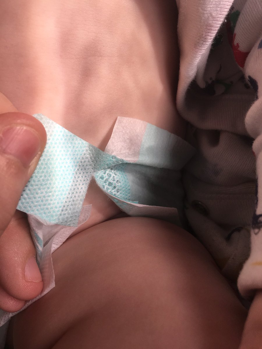 frazeeer's tweet photo. @Pampers what on earth is this? entire giga pack of botched nappies 👎🏻 https://t.co/iYrroj4uFL