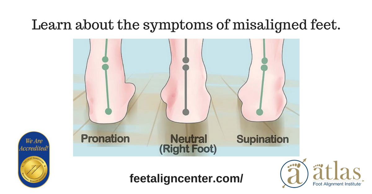 StopFeetPain's tweet photo. The more you know, the more you understand #MisalignedFeet #footpain
#FootHealthExpert - https://t.co/dg1GCco85Z https://t.co/549hvYBih0