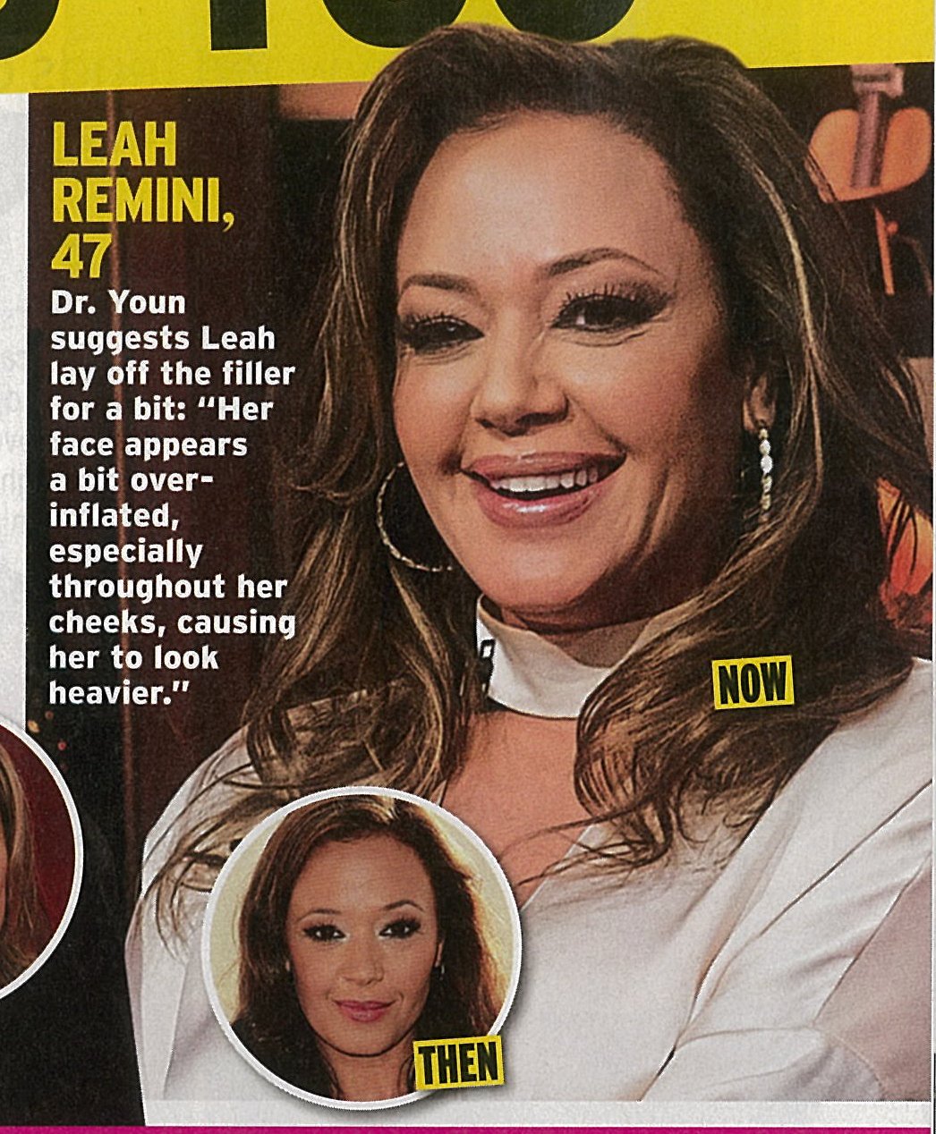 Leah remini plastic surgery online