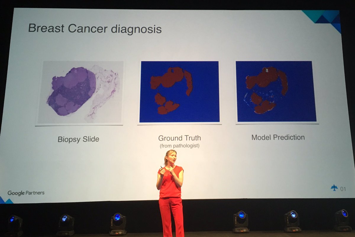 Imabroad_abroad's tweet photo. Can #google photo recognition use machine learning to help diagnose breast cancer? Seems it can. #masterclass2017 https://t.co/NbmQLQONDV