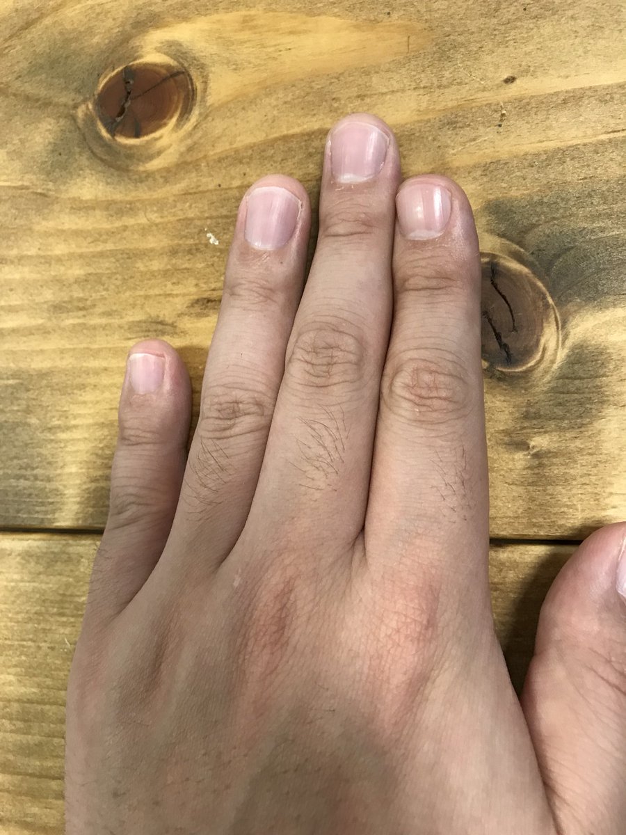 ギターを弾く上で手が小さいより小指が短い方が不利 マサヤングの日記帳