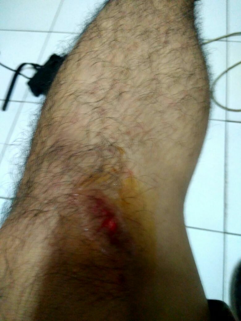 Beberapa korban represifitas aparat polisi yang terkena serangan pukulan dan intimidasi saat mencoba bertahan aksi #selamatkangunungslamet