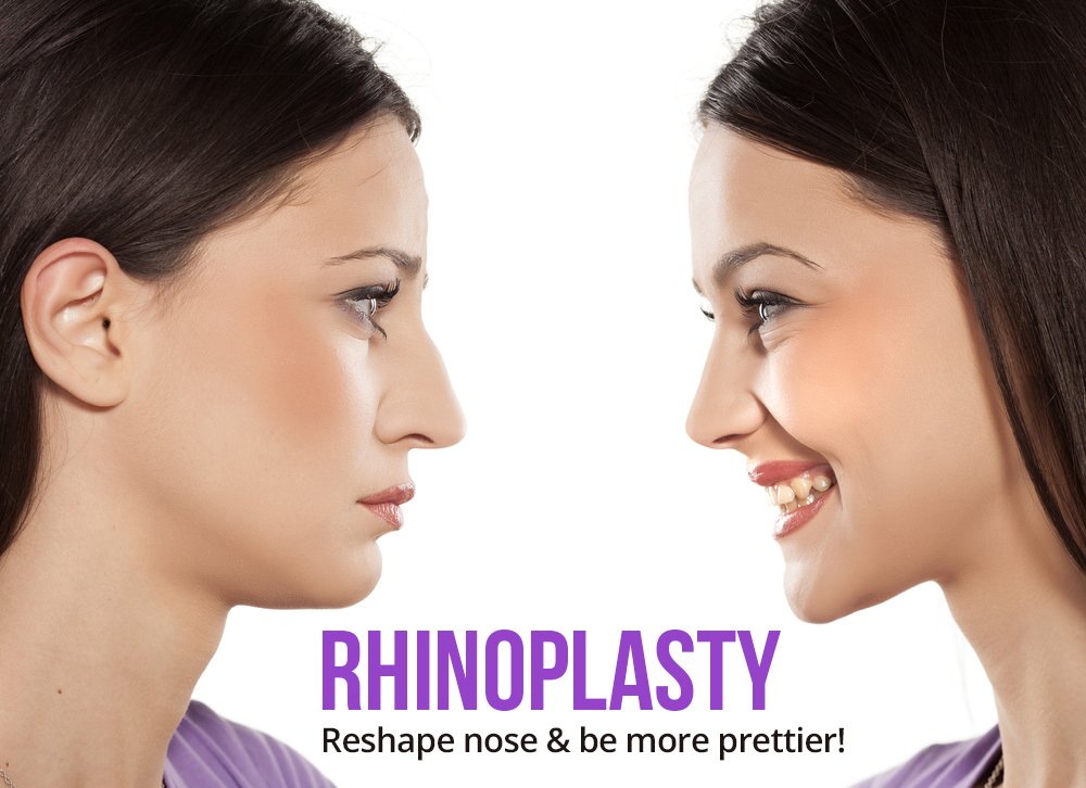 synergypsc's tweet photo. Be prettier through
#Rhinoplasty https://t.co/EQrlPyQzsi