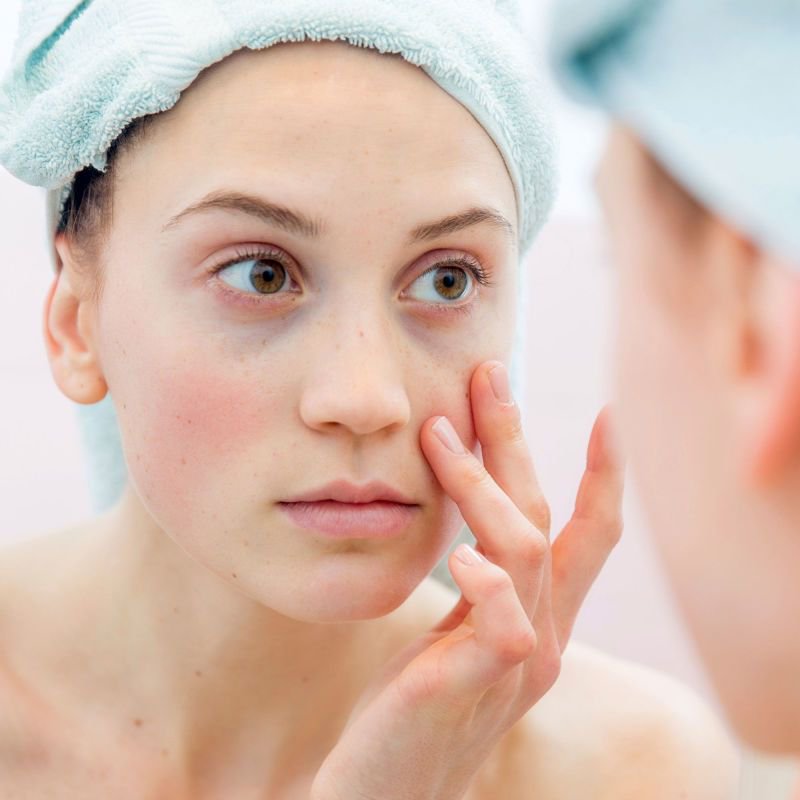 BSFcharity's tweet photo. All you need to know about #blackheads via @DrAnjaliMahto https://t.co/gkNJd6dFPA #acne #skin #spots #zits https://t.co/Rl6MrNpIsv