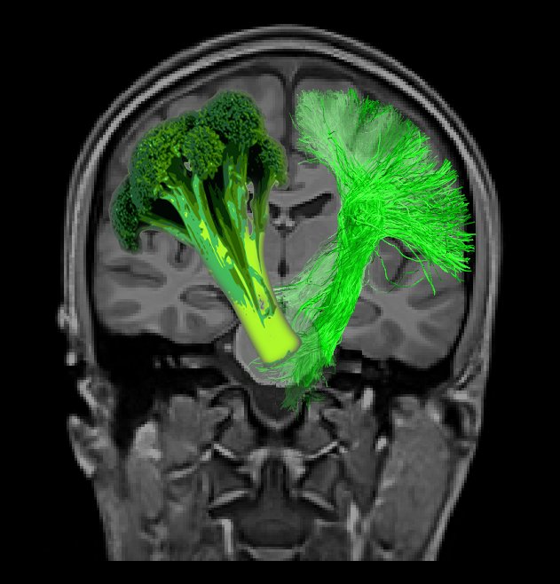 Neuro_Skeptic's tweet image. Neuro-broccoli. Winner of &quot;Brain-Art Competition 2016&quot; humor category neurobureau.org/galleries/brai… Some amazing images there!