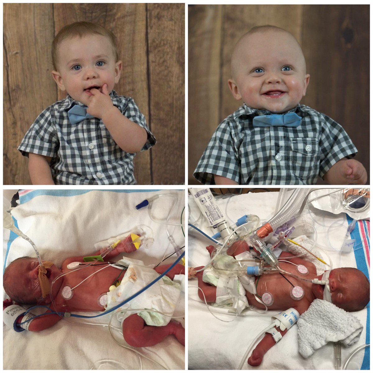 AmandaMarie1985's tweet photo. @VanessaLachey seeing your story in DWTS made me so emotional. My twins were born at 28 weeks. So scary, but made me so grateful 💙💙 https://t.co/ZTYOr5KBX0