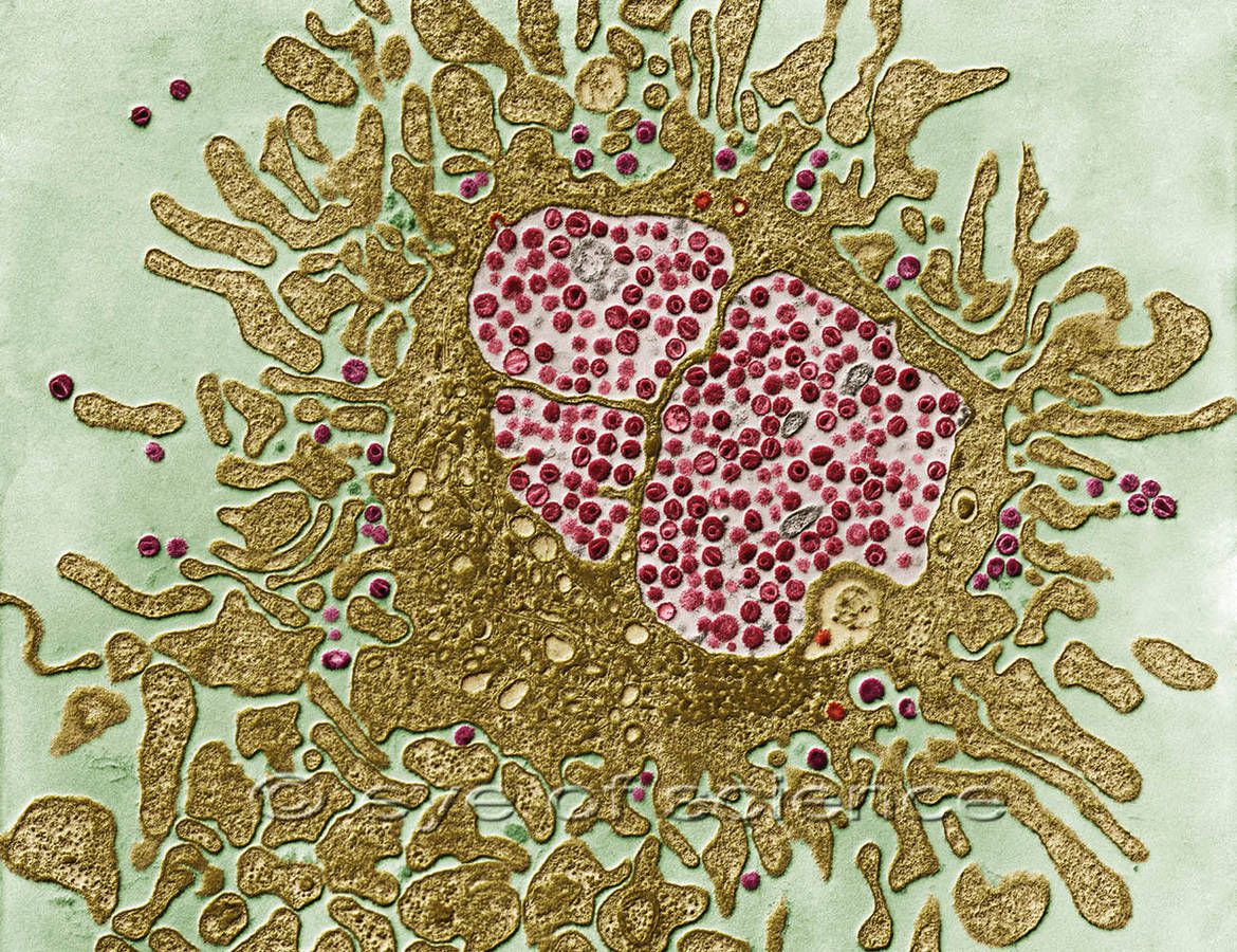 PATTERNITWEET's tweet photo. A @WellcomeTrust researcher, Helen Lee, won a European Inventor Award for her mobile HIV diagnostic kit
#INFECTIOUSPATTERN #positivepattern https://t.co/xJpnId0RiA