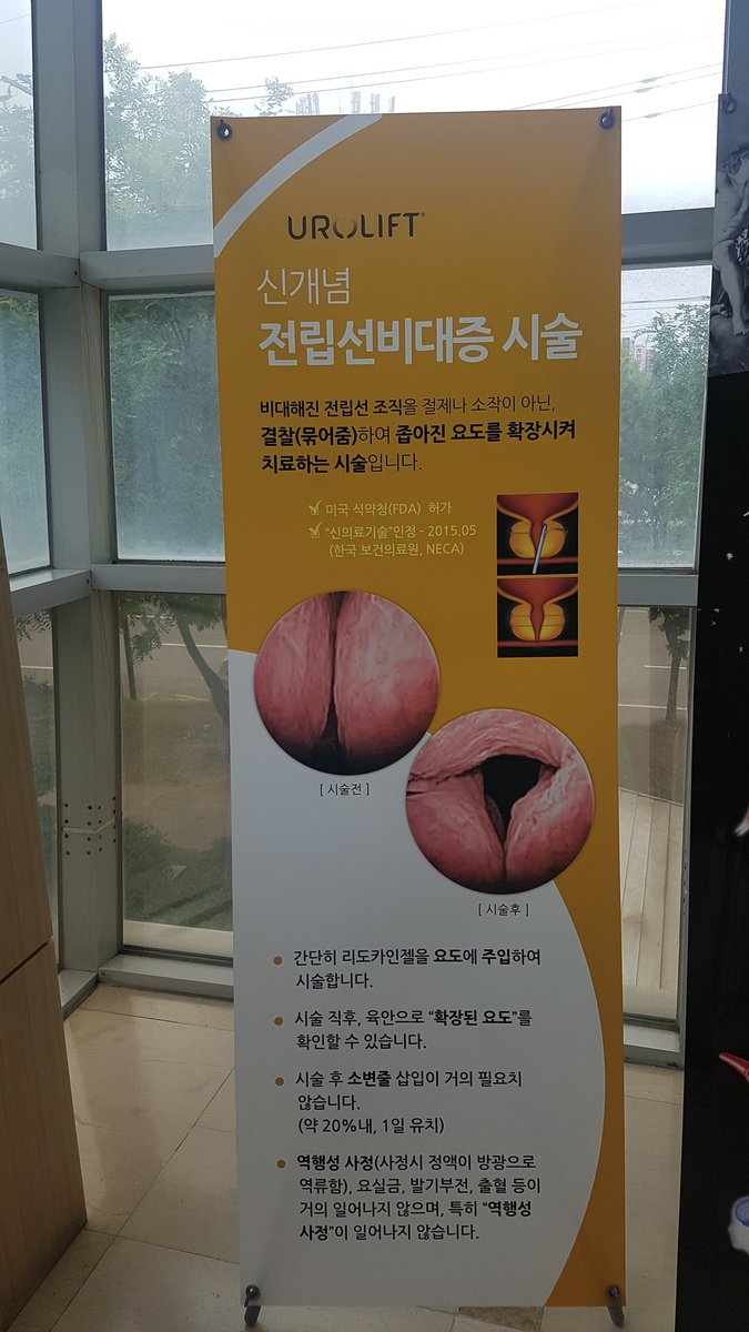 50대 이상 남성 중 많은 분들이 전립선 비대로 치료를 받고 있습니다. 시화 시흥안산 센트럴병원은 첨단 의료기기를 활용한 간단한 시술법으로 전립선비대증을 치료하고 있습니다.