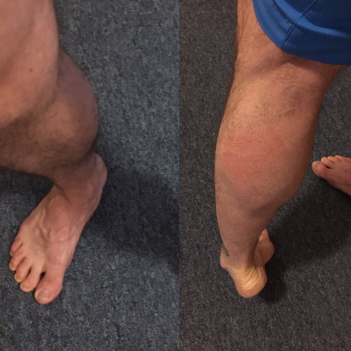 Welshinlondon's tweet photo. Kind of obsessed with growing my legs at the moment. Focused on calves earlier: high rep sets; multiple exercises. #keeppusing #fitfam https://t.co/0En0t0W2q3