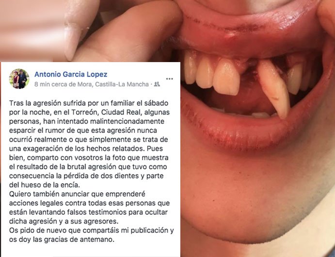 Hoy os pido ayuda para difundir la brutal agresión que ha sufrido mi sobrino en Ciudad Real y que está intentado silenciar los agresores.