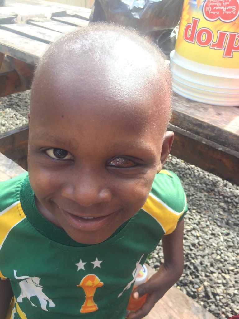 TcccThe's tweet photo. Jambo Alex, what a fantastic smile!!! https://t.co/yJUD7nCjY1