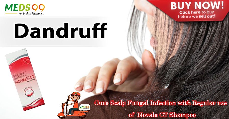 Meds99Official's tweet photo. Cure Scalp #FungalInfection with Regular use of #NovaleCTShampoo https://t.co/c3UYzxXe9P https://t.co/QexHXBw9V3