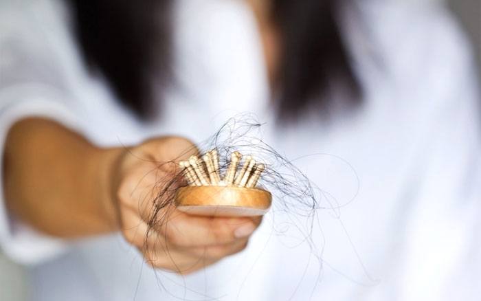 GetUpTo_Speed's tweet image. Hair Loss: A Guide To Causes and Remedies lisaspeed.com/natural-remedi…