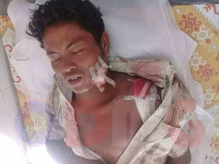 eithetthetaung3's tweet photo. Yesterday,this Dinnet men attacked and killed by Bengali terrorists.Where is humanity for them? https://t.co/riQT08ymEM