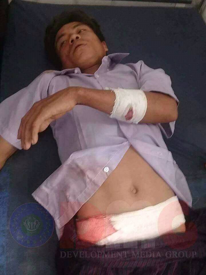 eithetthetaung3's tweet photo. Yesterday,this Dinnet men attacked and killed by Bengali terrorists.Where is humanity for them? https://t.co/riQT08ymEM