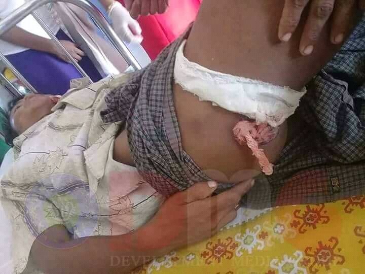 Yesterday,this Dinnet men attacked and killed by Bengali terrorists.Where is humanity for them?