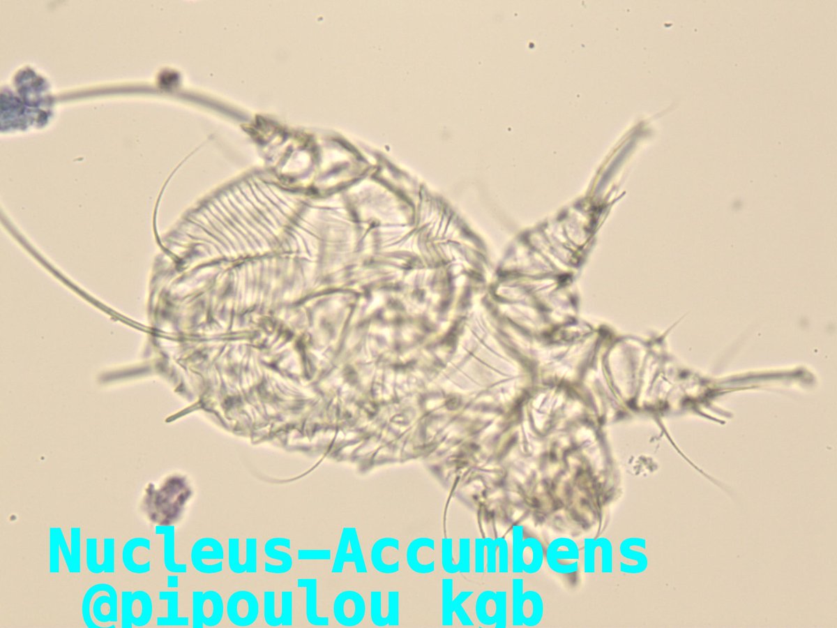 Gratte, gratte, gratte... <a href="/ArzeElizabeth/">Elizabeth Arze</a> <a href="/KCampbellMD/">Katelynn Campbell</a> <a href="/Manu_Iglesias81/">Manuelita Iglesias</a> <a href="/saraehiggins1/">Sara Higgins, MD</a> <a href="/Tiff_Caza/">Tiffany Caza</a> @PeymanDin83 <a href="/BarbaraPath/">Barbara Vidal, MD</a> <a href="/baz_vahide/">Vahide Baz</a>