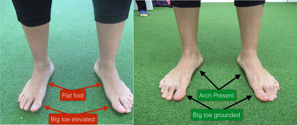 hcmovement_ie's tweet photo. Fron KNEE PAIN to ZERO in just 12-weeks - https://t.co/HthyPR2zzN https://t.co/kM4JkeVpvF
