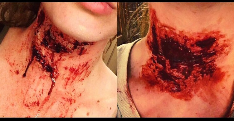 DestielAlyssa's tweet photo. @Glam_And_Gore I rarely ever use silicone so this isn’t the best but here’s an improvement from last year!! 2017 vs. 2016 https://t.co/4utrt8UDKP