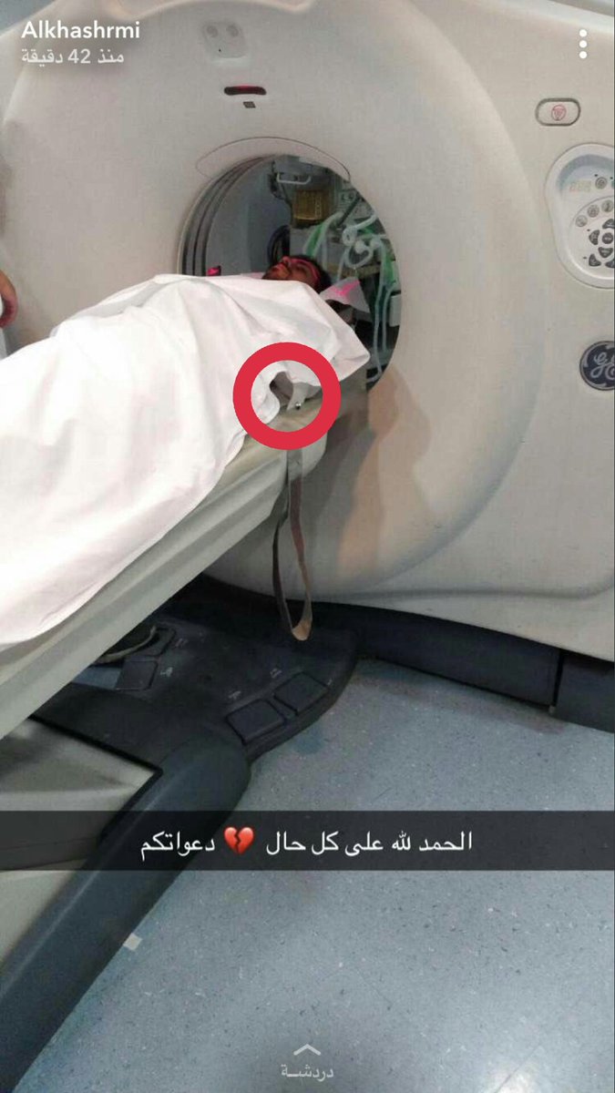 #الخشرمي_بالمستشفي_يطلب_دعاءكم
انا مابي اتبلىا ع الرجال.. الله يشفيه بس اتوقع في الاشعه المقطعيه لازم يوخرون  الكبك بس اشوف الكبك ما وخروه