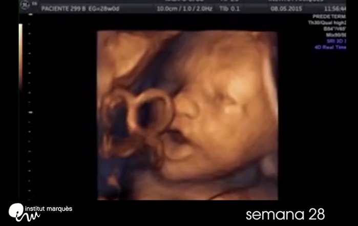 StevenErtelt's tweet photo. Liberals are Mad That President Trump is Trying to Save an Unborn Baby From Abortion https://t.co/F4nPXQGKk8 #IHaveEveryRightTo #Prolife https://t.co/hOfFiuH9eR