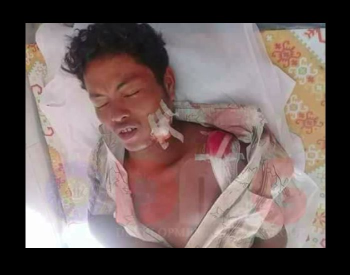 Four Daingnet ethnics from Aungthapray Village was shot by #Bengali #arsa so-called #Rohinygas on the 22nd of Oct. Two were killed instantly