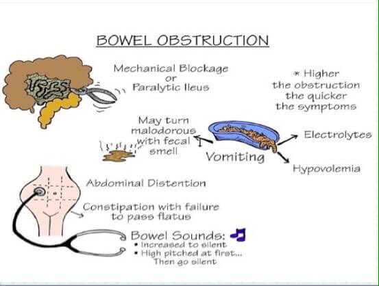 [ SEKILAS ILMU ]

Sekilas Ilmu ttg B20M2. 

#SekilasIlmu💡
#B20M2
#WeShareToStudy
#KnowledgeIsPower
#BEMFKUnmul
#BEM_RumahKita
#LetsGoBuild
