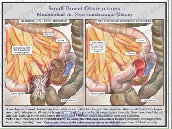 [ SEKILAS ILMU ]

Sekilas Ilmu ttg B20M2. 

#SekilasIlmu💡
#B20M2
#WeShareToStudy
#KnowledgeIsPower
#BEMFKUnmul
#BEM_RumahKita
#LetsGoBuild