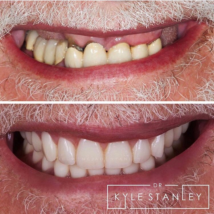 BHdentistry's tweet photo. #MakeoverMonday 😄 https://t.co/zTPPP8090Q