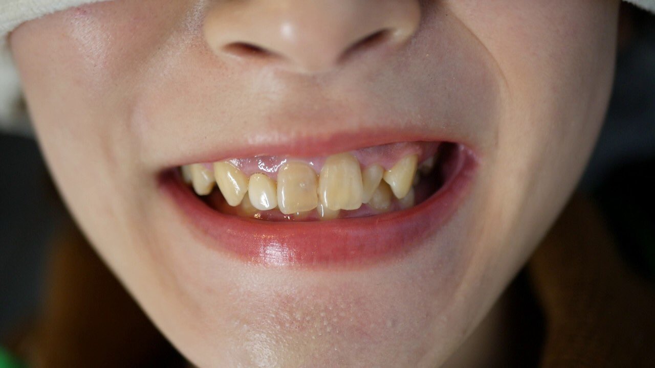 Platinum Whitening Platinumwhitejp Twitter