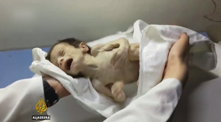 AJEnglish's tweet photo. "Infant death rates have dramatically increased"
Civilians blockaded & trapped by the Syrian regime in east Ghouta https://t.co/SzO2X6RYr1 https://t.co/1urhoaUG78