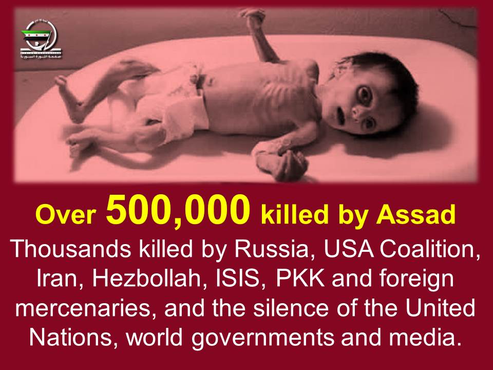 RevolutionSyria's tweet photo. For over 6.5 years.
#Assad is not alone killing Syrians,
And siege & starvation are not the only means.
#Syria #Genocide https://t.co/9aO6m3wQ9q