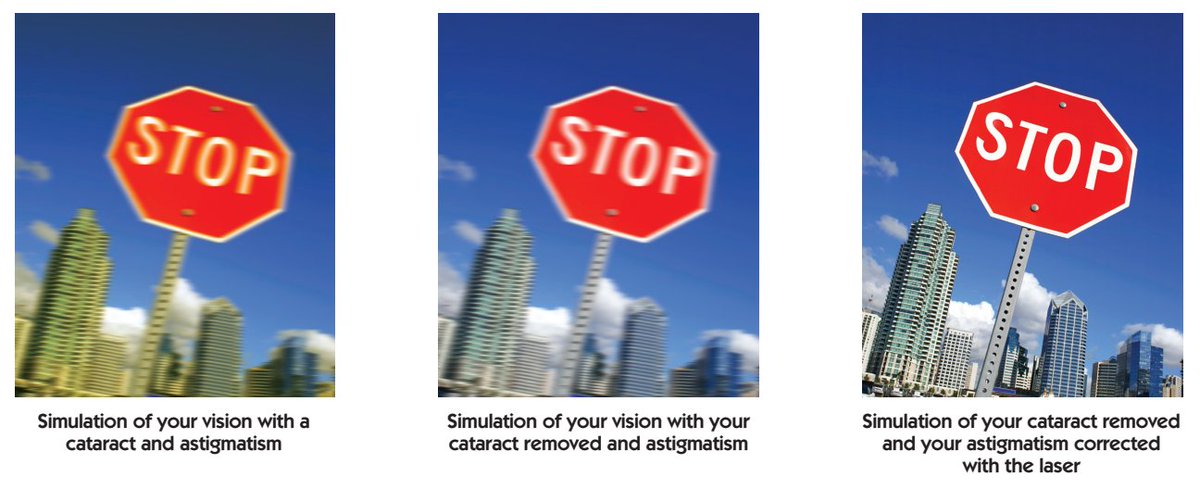 My_Jacksoneye's tweet photo. See how much clearer your eyesight could be with your cataract or astigmatism corrected? Learn more at https://t.co/JfKIK2Y5kP https://t.co/7ZOTiQQ2tb