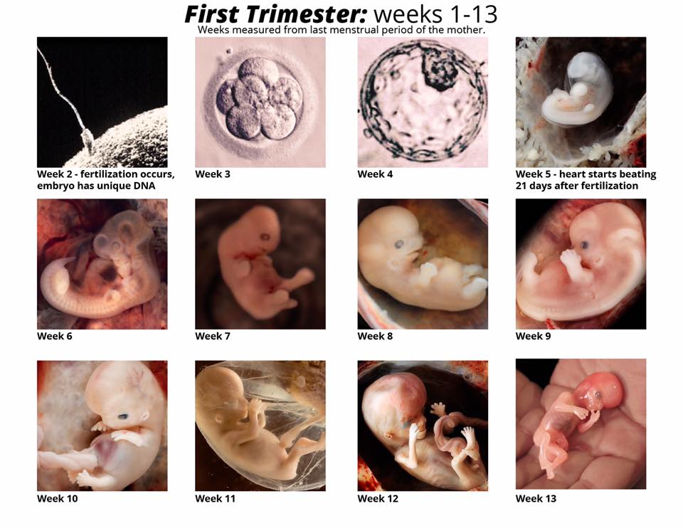 LilaGraceRose's tweet photo. Every abortion ends of the life of a valuable and unique human being -- our little brothers and sisters. Retweet to share the truth! https://t.co/Msh4vVH69x
